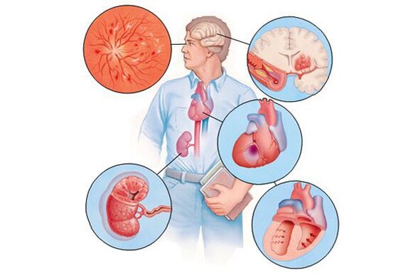 Įvairių organų, turinčių ilgalaikę arterinę hipertenziją, žala